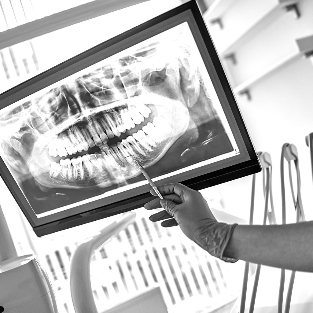 Tecniche Passion Smile Aesthetic Dental Clinic